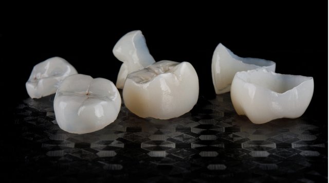 Coroană dentară din zirconiu monolitic realizată la Novora