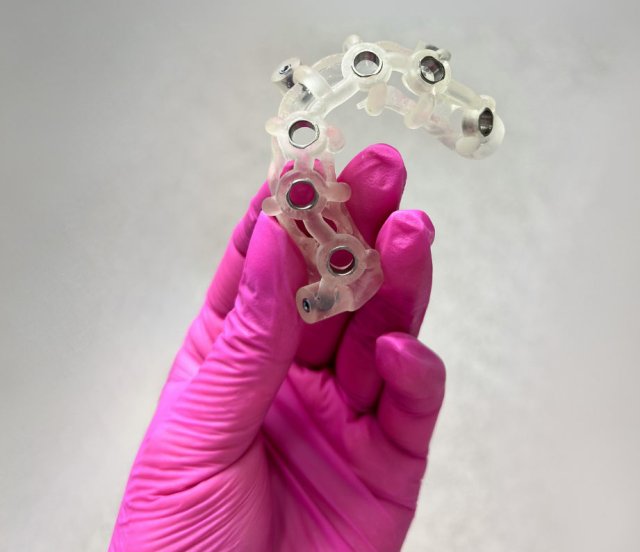 Planificare digitală și ghid chirurgical 3D pentru implant dentar
