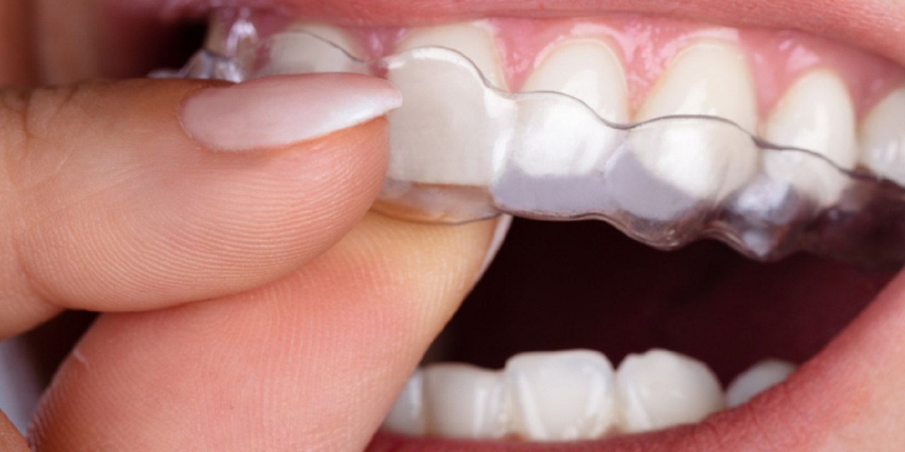 tratament orto iasi clear aligners