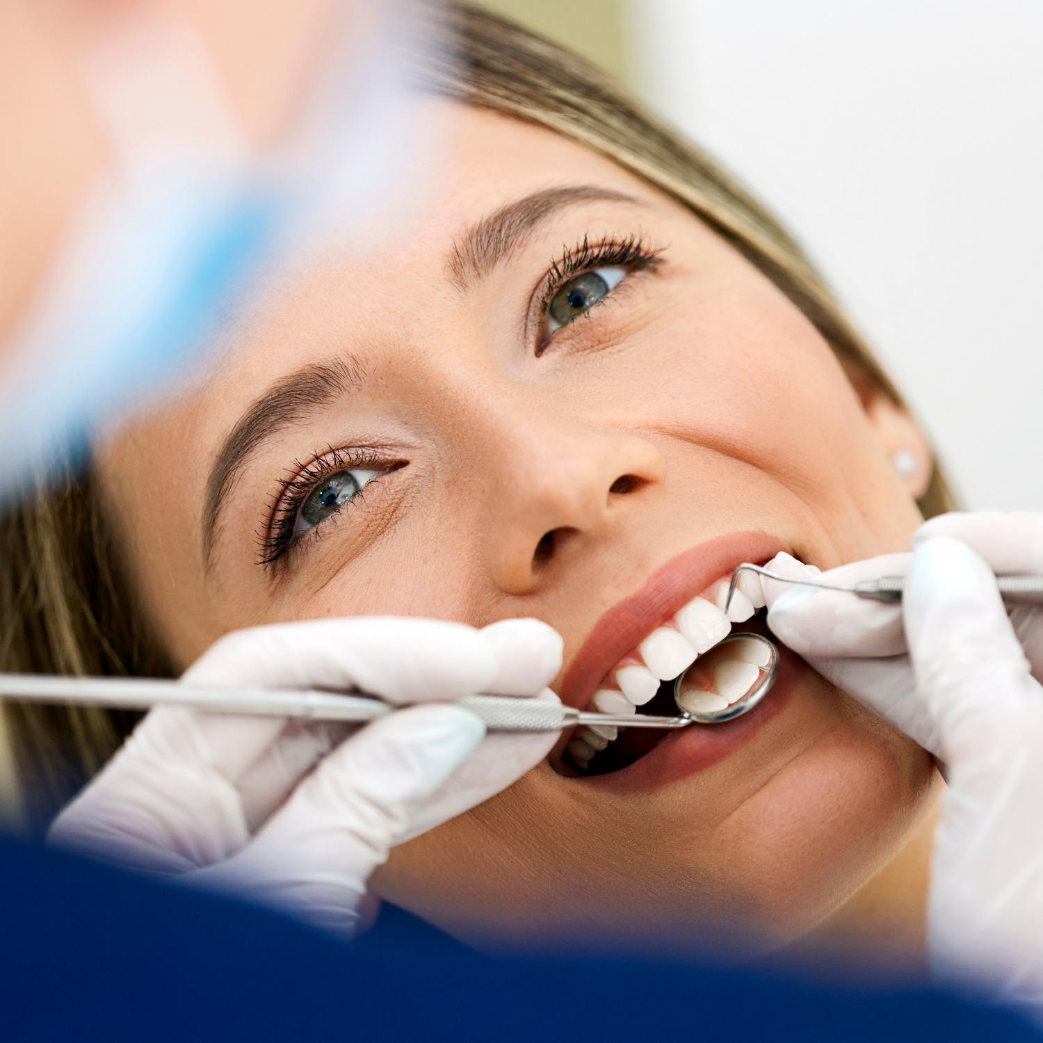 Tratament carii dentare