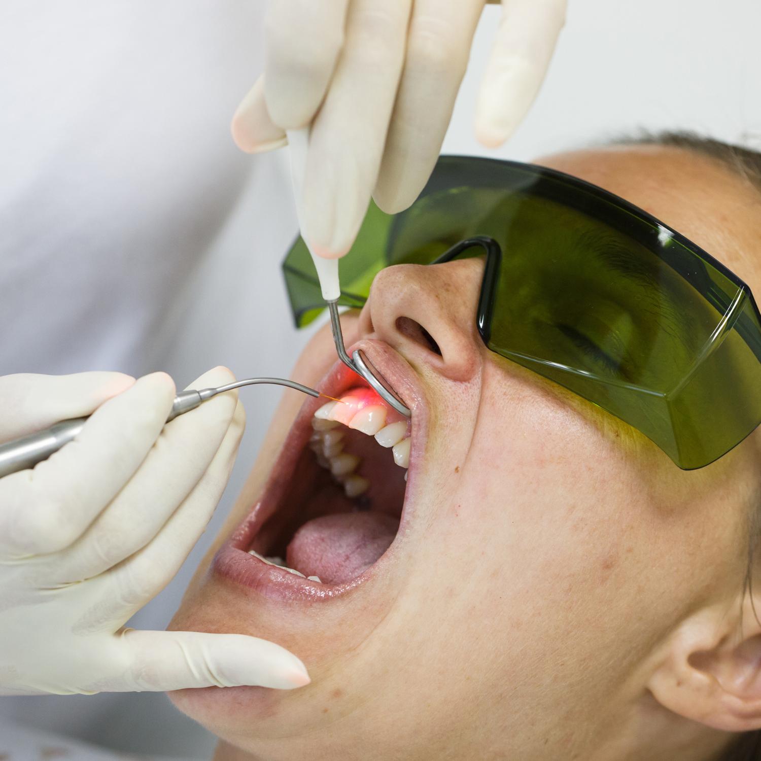Stomatologie Laser