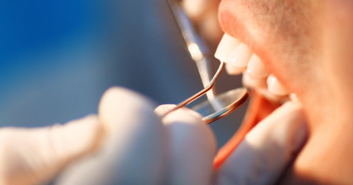 Infecție dentară netratată și pierderea dinților: riscuri, simptome și tratament